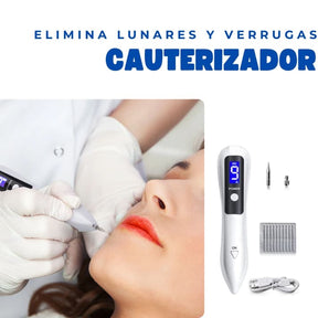 Elimina imperfecciones al instante con el cauterizador