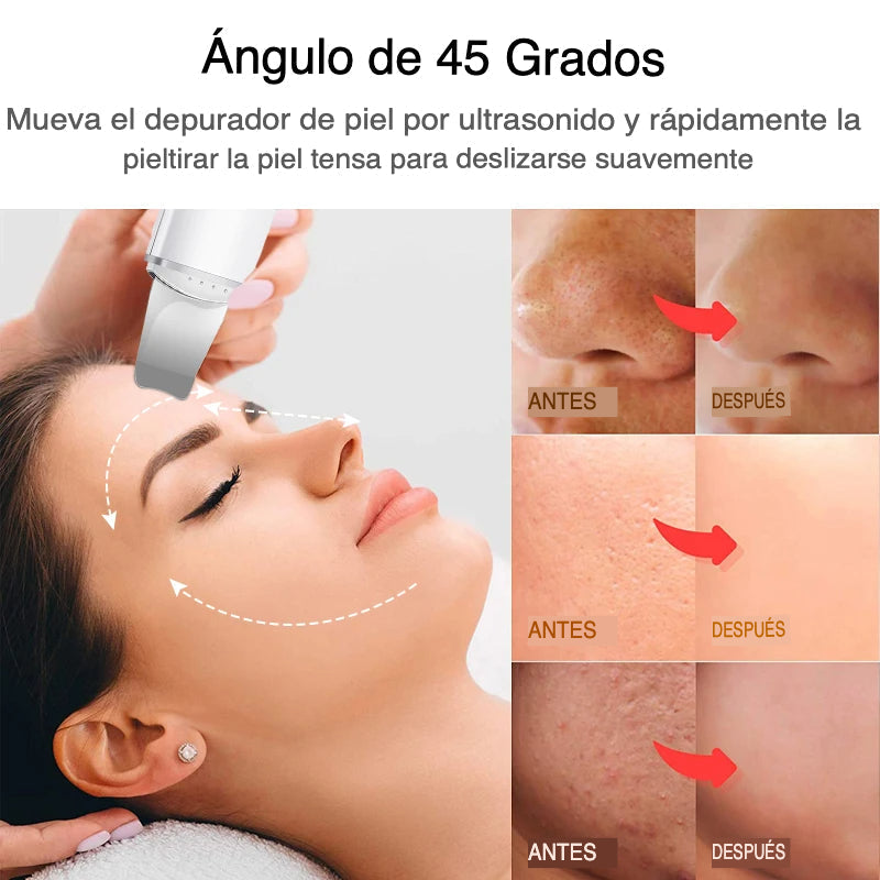 Exfoliador Ultrasónico Para Una Piel Radiante