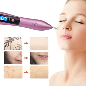 Elimina imperfecciones al instante con el cauterizador
